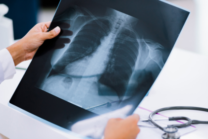 Dra. Thaline Neves explica como a radiologia pode apoiar o envelhecimento saudável com exames essenciais para a terceira idade.