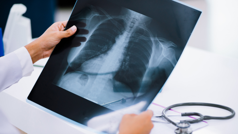 Dra. Thaline Neves explica como a radiologia pode apoiar o envelhecimento saudável com exames essenciais para a terceira idade.